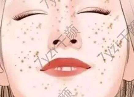 為什么皮秒激光如此受歡迎